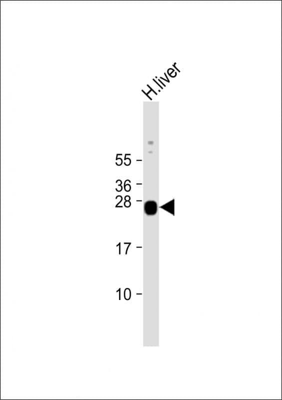 GSTA5 Antibody (N-Terminus)