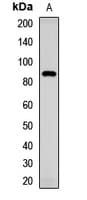 Polyclonal Rabbit anti-Human transmembrane channel-like 1 Antibody (WB)