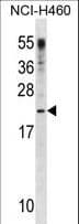 Polyclonal Rabbit anti-Human CSF3 / G-CSF Antibody (aa180-207, WB)