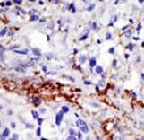 Polyclonal Rabbit anti-Human USP21 Antibody (aa406-436, IHC, WB)