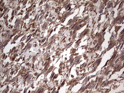 Monoclonal Mouse anti-Human BFSP2 Antibody (clone OTI4E7, aa184-415, IHC, WB)