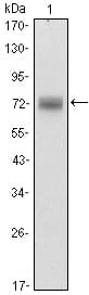 IHC-plus™ ZBTB16 / PLZF Antibody (clone 5B3)