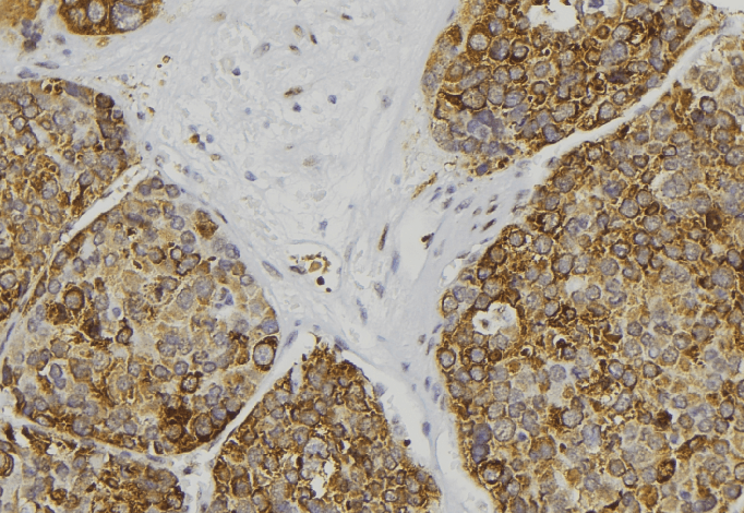 AWAT2 / DGAT2L4 Antibody
