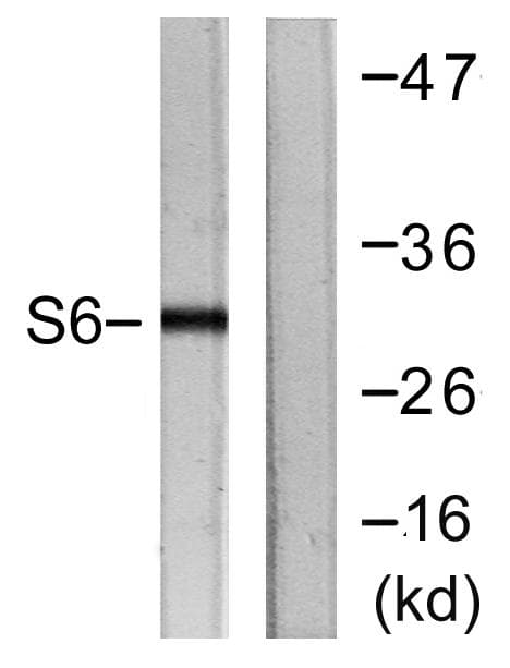 RPS6 / Ribosomal Protein S6 Antibody (p240)