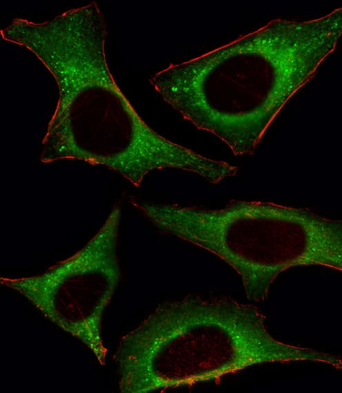 PIK3CD / PI3K Delta Antibody (aa687-717)