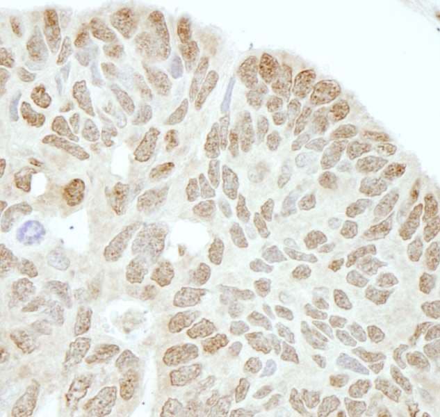 DROSHA / RNASEN Antibody (aa1050-1100)