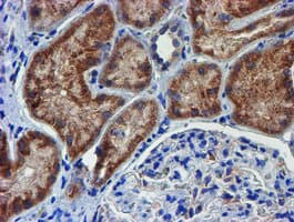 PDSS2 / DLP1 Antibody (clone OTI1C11)