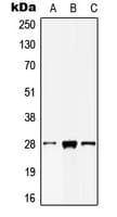Polyclonal Rabbit anti-Human MOB2 Antibody (N-Terminus, WB)
