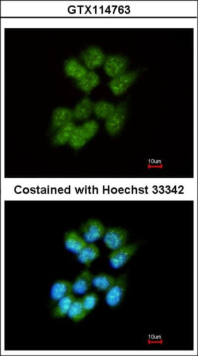 SLA Antibody (aa1-276)