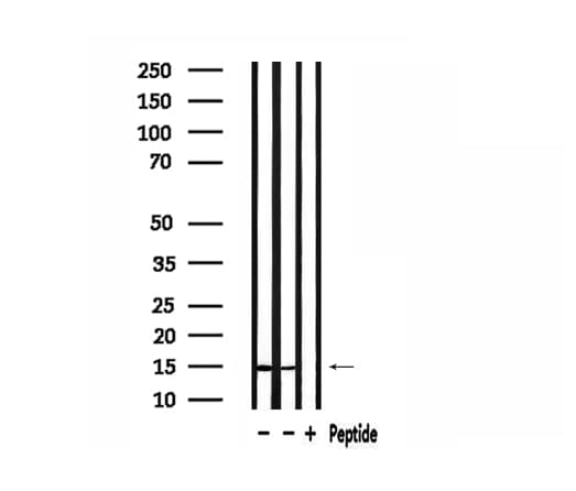RPS19 / Ribosomal Protein S19 Antibody