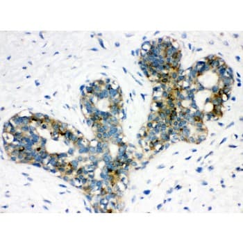 ARSA / Arylsulfatase A Antibody (aa454-482)