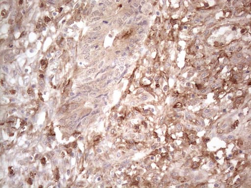 Monoclonal Mouse anti-Human PROCR / EPCR Antibody (clone OTI12H5, aa1-210, IHC, WB)