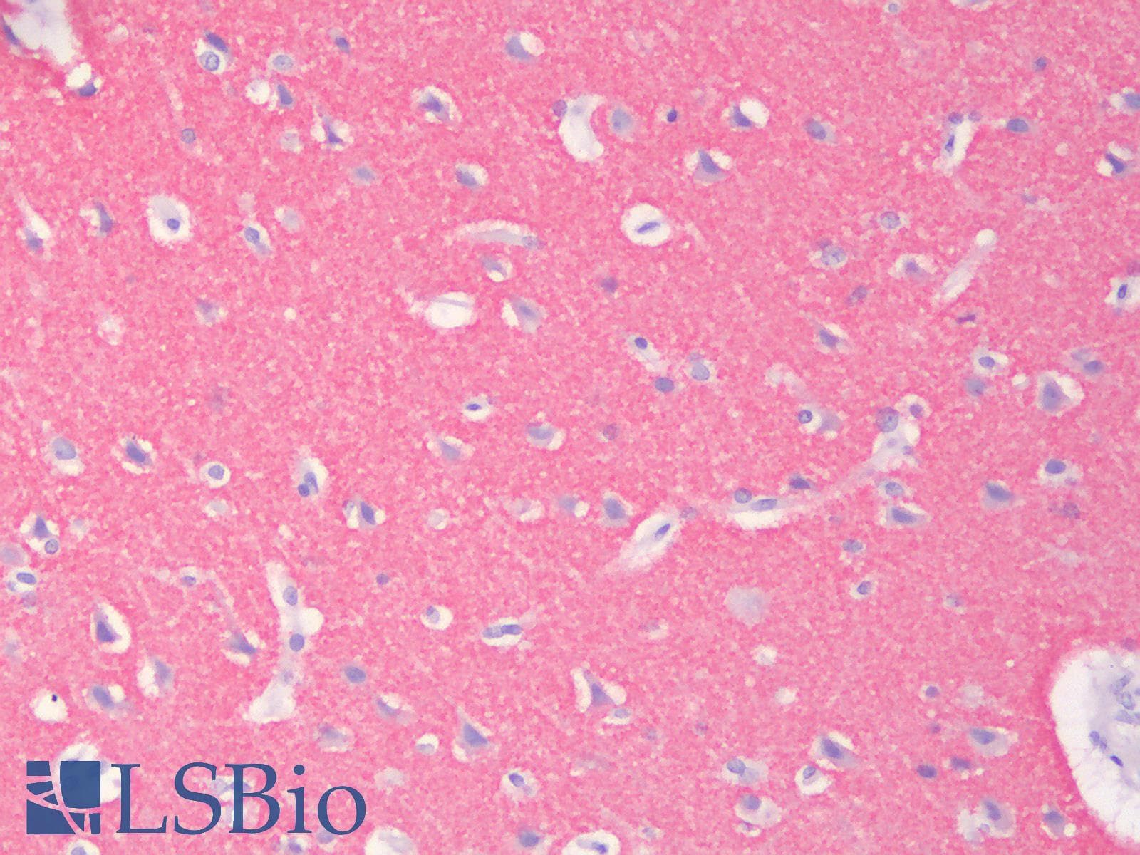 PathPlus™ SYP / Synaptophysin Antibody