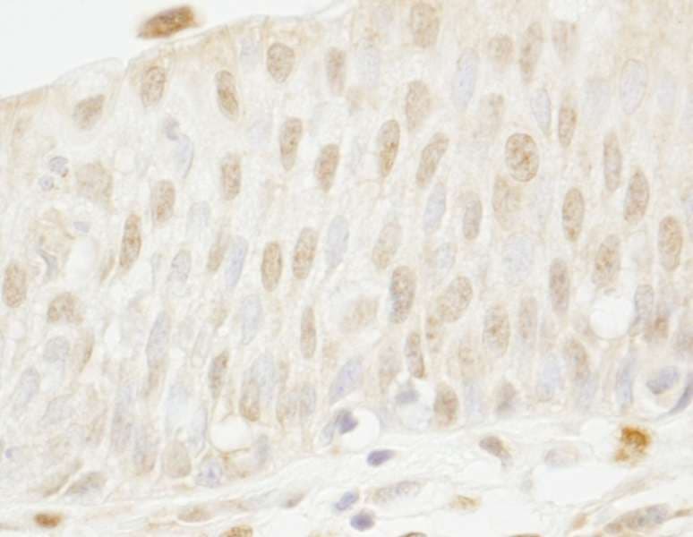 Polyclonal Rabbit anti-Human MYBBP1A Antibody (aa450-500, IHC)