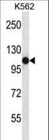 SEMA4C / Semaphorin 4C Antibody (aa792-821)