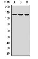 ZEB1 / AREB6 Antibody