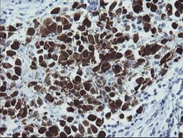 MAGEA4 Antibody (clone 1F9, Carrier-free)