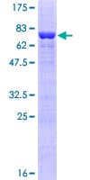 Human THRA / THR Alpha Protein (Recombinant GST)