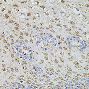 PLK4 / SAK Antibody