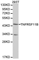 OPG / Osteoprotegerin Antibody