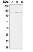 Polyclonal Rabbit anti-Human ACTN2 Antibody (N-Terminus, IHC, IF, WB)