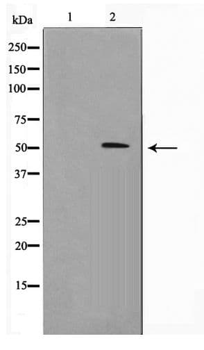 CYP2J2 Antibody