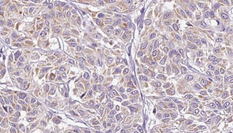 Polyclonal Rabbit anti-Human IL28B Antibody (IHC, IF, WB)