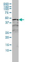 IHC-plus™ Monoclonal Mouse anti-Human RARA / RAR Alpha Antibody (clone 2C9-1F8, IHC, IF, WB)