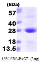 Human SAR1A / SAR1 Protein (Recombinant His)