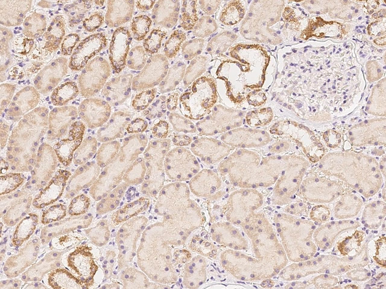PCBP4 Antibody