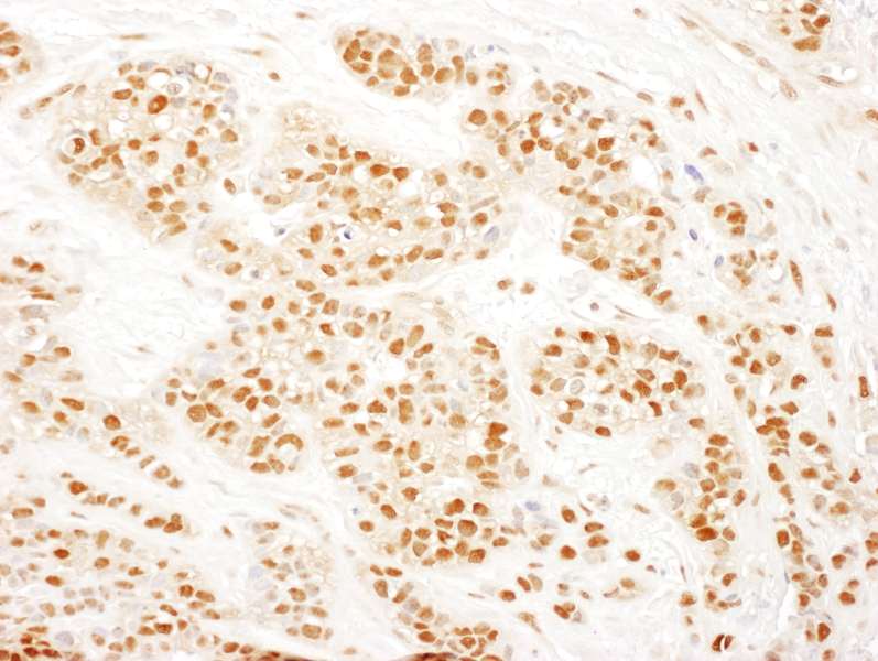 Polyclonal Rabbit anti-Human RAD23B / HR23B Antibody (aa359-409, IHC, WB)