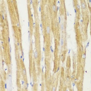 Polyclonal Rabbit anti-Human TOMM20 Antibody (IHC, IF)