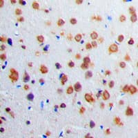 Polyclonal Rabbit anti-Human ADCY1 / Adenylate Cyclase 1 Antibody (Internal, IHC, WB)