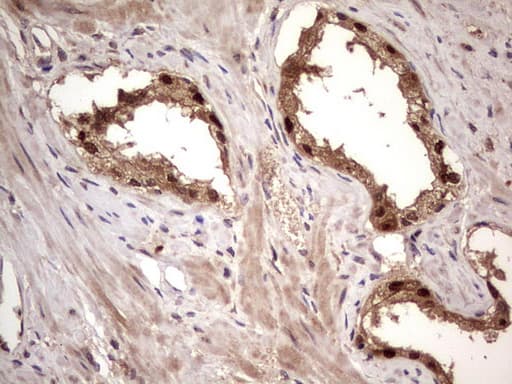 Monoclonal Mouse anti-Human BFSP2 Antibody (clone OTI4E7, aa184-415, IHC, WB)