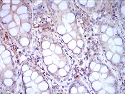 CD14 Antibody (aa20-214, clone 1H5D8)