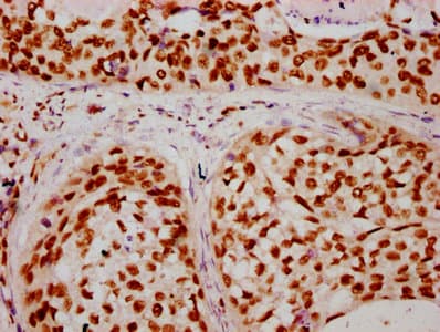Polyclonal Rabbit anti-Human HIST1H2BN Antibody (IHC, IF, WB)