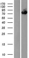 ACOX3 Protein (Over-Expression Lysate Myc-DDK (Flag))