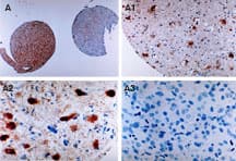 Polyclonal Rabbit anti-Human BIRC2 / cIAP1 Antibody (aa158-175, IHC, WB)