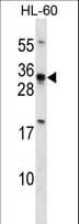 HOXB8 Antibody (aa215-243)