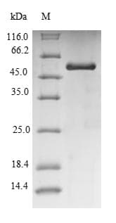 Pig Uricase Protein (Recombinant 6His-SUMO, N-terminus)