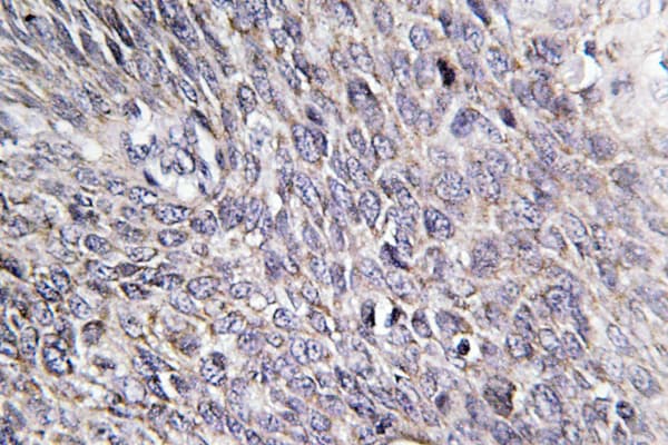 CHPF / CHSY2 Antibody (Arg671)