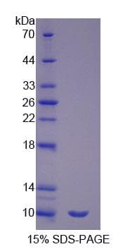 Human SFTPA2 / Surfactant Protein A2 (Recombinant His-S)