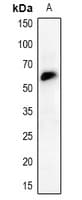 CHEK2 / CHK2 Antibody