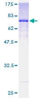 Human ALDH3B1 Protein (Recombinant GST)