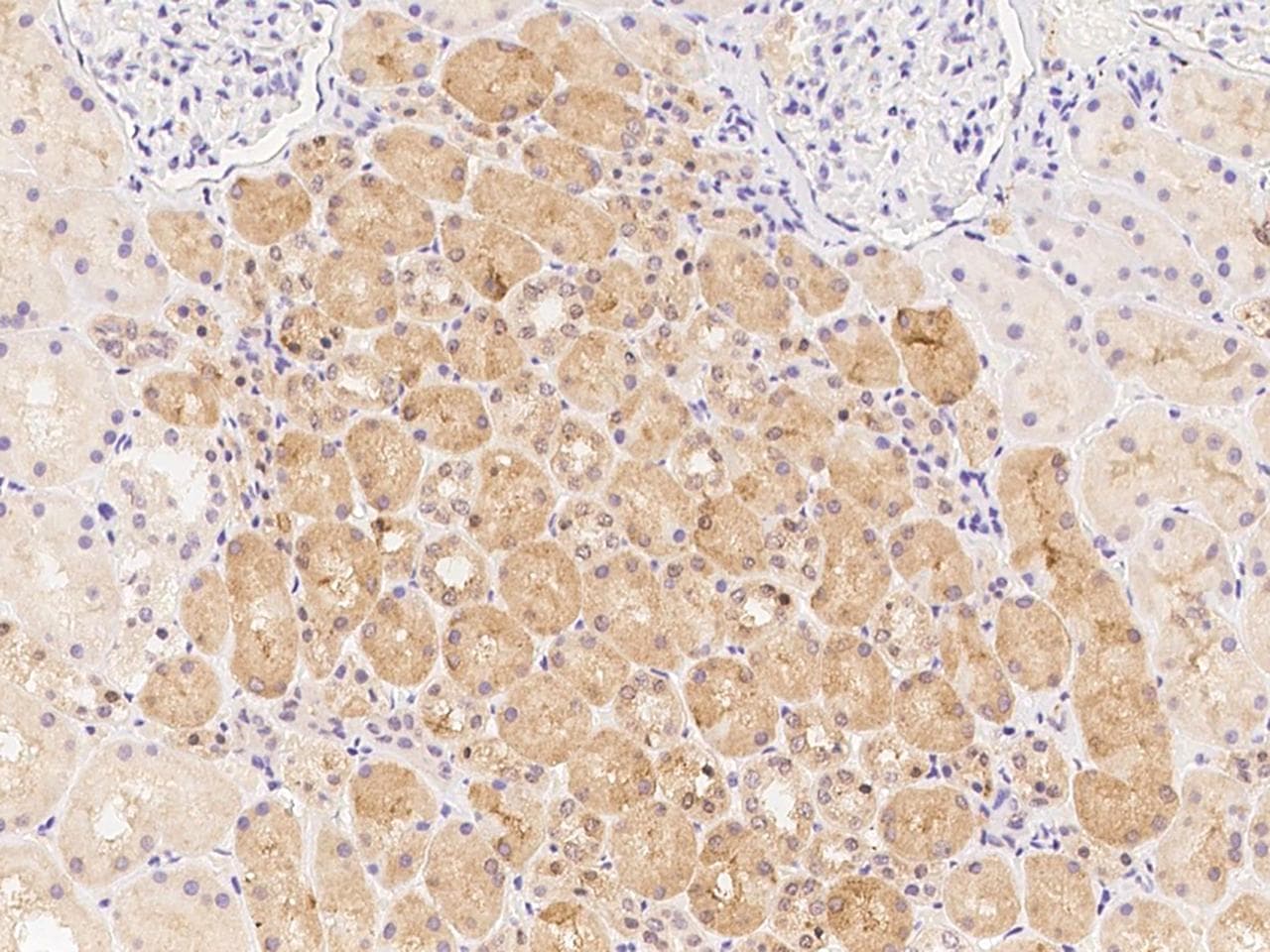 Polyclonal Rabbit anti-Human UGT3A1 Antibody (IHC)