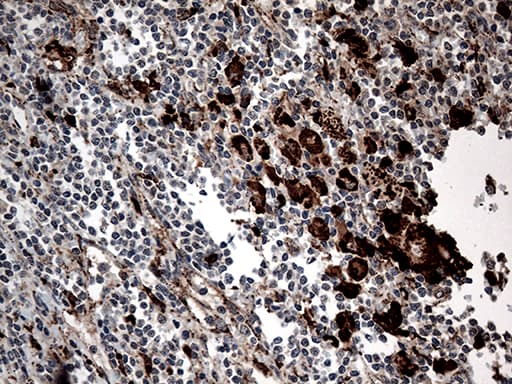 Monoclonal Mouse anti-Human CTSL / Cathepsin L Antibody (clone OTI1C7, aa114-333, IHC, WB)