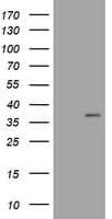 Monoclonal Mouse anti-Human COPS6 / CSN6 Antibody (clone OTI2F5, IHC, WB)
