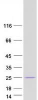 Human MED8 Protein (Recombinant Myc-DDK (Flag))