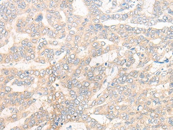 Polyclonal Rabbit anti-Human CYB5R3 / B5R Antibody (IHC)