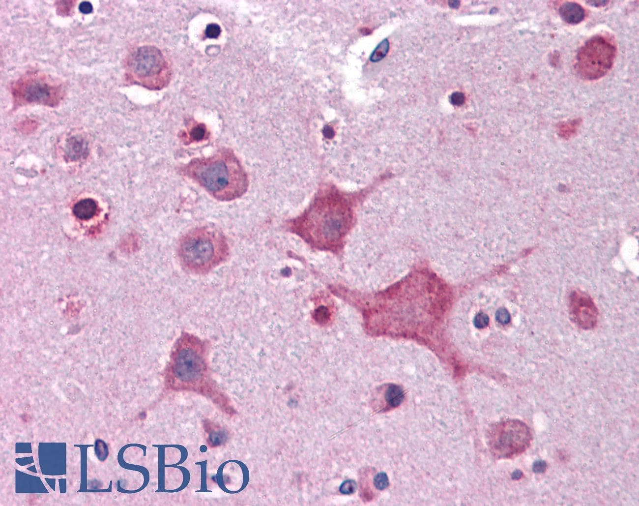 IHC-plus™ Dipeptidylpeptidase 10 / DPP10 Antibody (aa760-773)